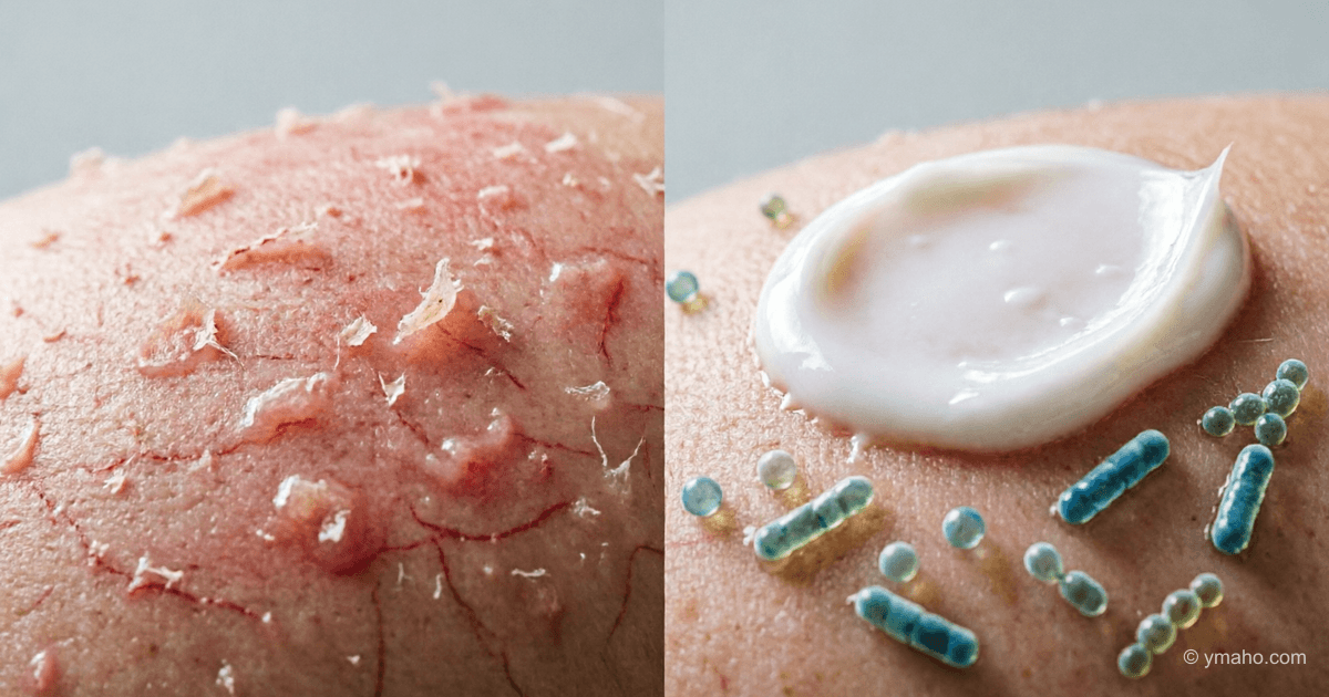 益生菌护肤：微生物组化妆品——年度趋势