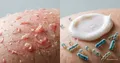 Probiotics for skin: microbiome cosmetics — trend of the year