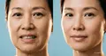 Dental anti-age: bite as the foundation of facial youth
