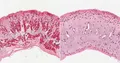 Benralizumab pour l'œsophagite à éosinophiles : approbation de l'EMA en 2026