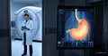 Mayo Clinic AI: Pancreatic Cancer 475 Days Before Diagnosis