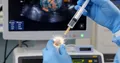 Oncolytic Virotherapy of Pancreatic Cancer: Successes The Lancet
