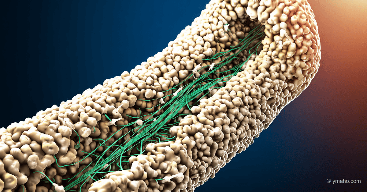 Titanimplantate mit Knochenmaskierung – Entwicklung des IPTT RAS
