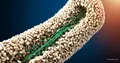 Titanium implants with bone masking — development by IPTT RAS