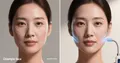 Ozempic face correction: 2026 protocols