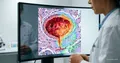AI test for bladder cancer: FDA breakthrough device