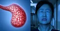 Quincke's edema as a mask of hypothyroidism: a systemic diagnostic failure